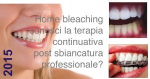 home bleaching
