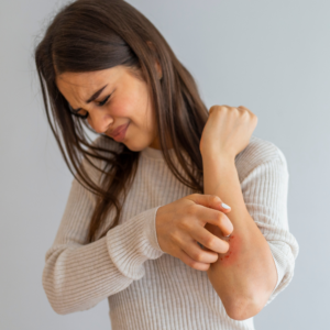 Psoriasi: i consigli per riconoscerla e affrontarla